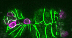 Biologists discover a trigger for cell extrusion