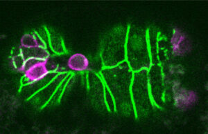 Biologists discover a trigger for cell extrusion