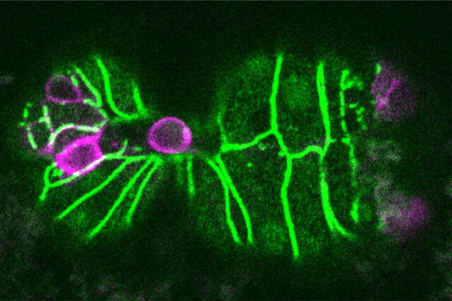 Biologists discover a trigger for cell extrusion