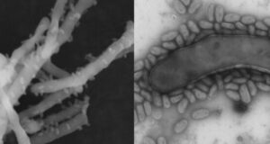 Discovery of new organism could solve common problem in wastewater treatment