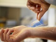 New material to treat wounds can protect against resistant bacteria