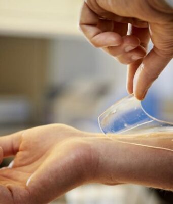New material to treat wounds can protect against resistant bacteria