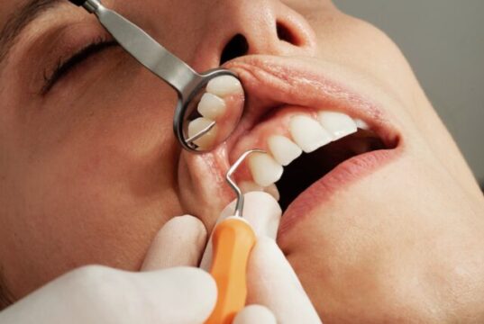 dental chisel by caroline lm via unsplash